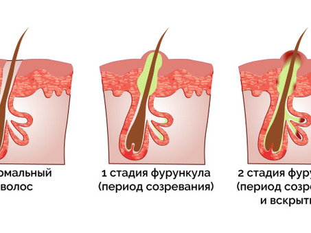 купить семена, купить семена суданской травы, купить семена суданской травы сорта анастасия, семена суданской травы сорта анастасия, семена суданской травы анастасия, анастасия, суданская трава, семена суданской травы анастасия, цена суданской травы анаст